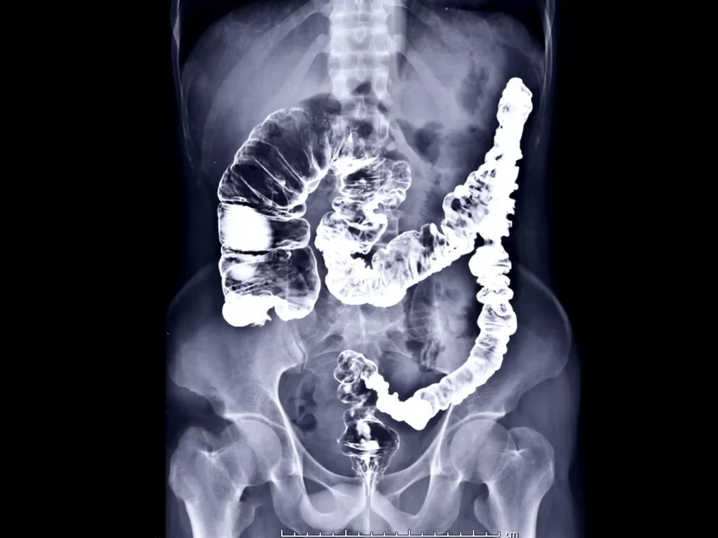 Fluoroscopy