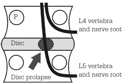 Kemer MRI+ Interpretation of Kemer MRI Response