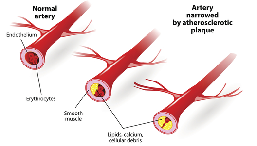 Diagnosis of heart disease with CT scan