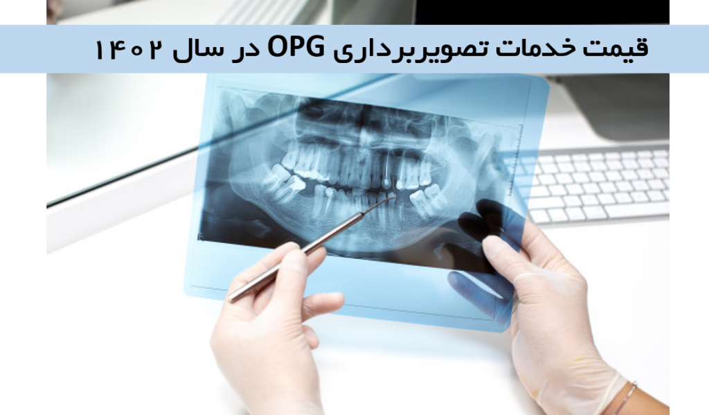 قیمت OPG