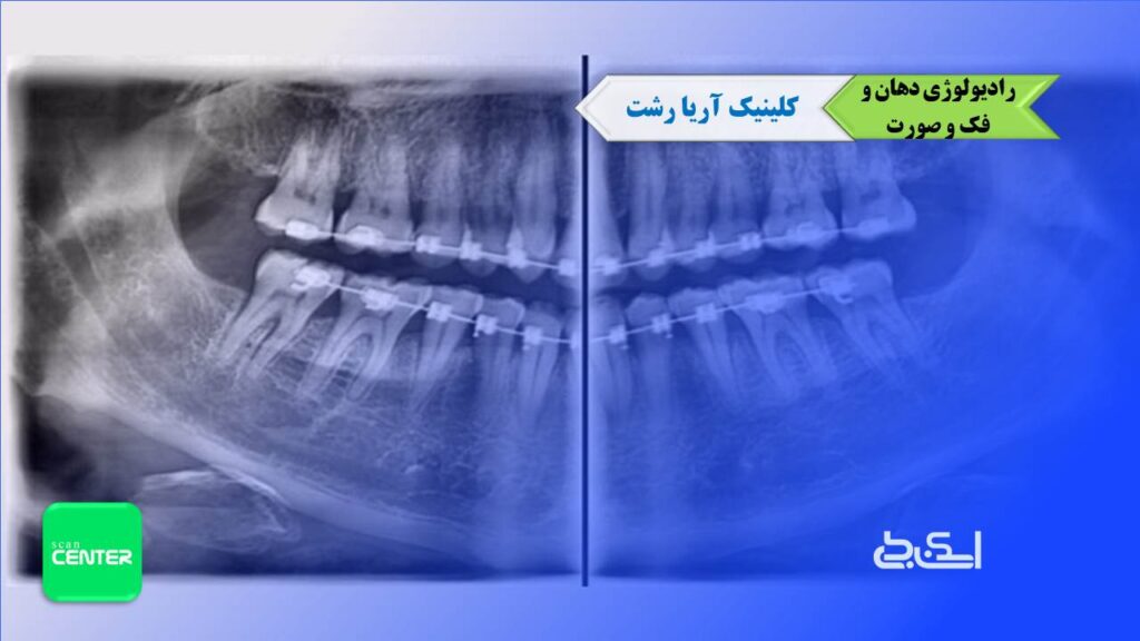 آریا رشت رادیولوژی فک و دهان و صورت