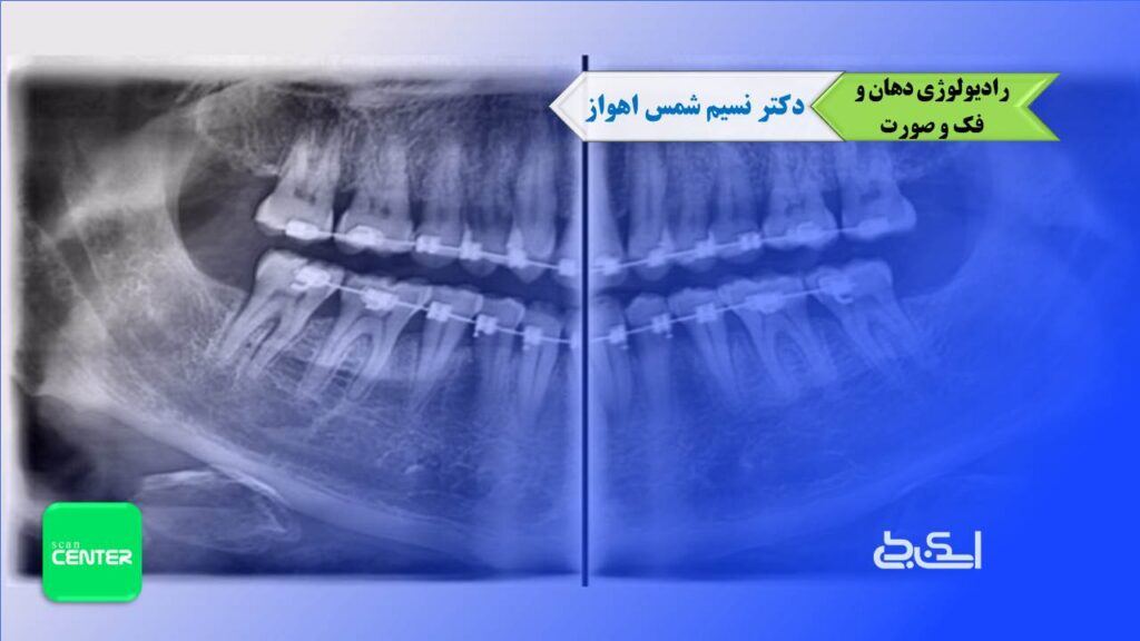 رادیولوژی دهان فک و صورت دکتر نسیم شمس اهواز