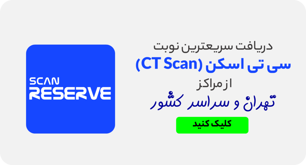 سریعترین نوبت سی تی اسکن در تهران