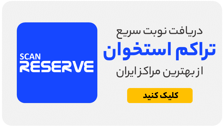 نوبت تراکم استخوان مرکز تهران