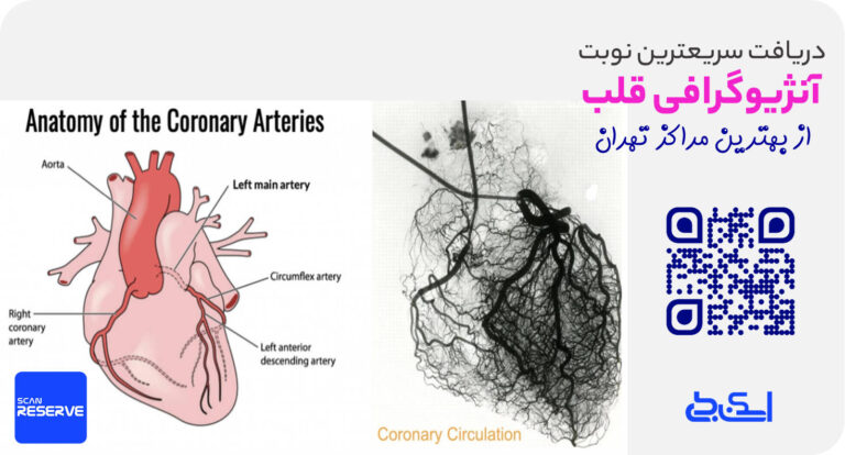 آنژیوگرافی قلب شرق تهران