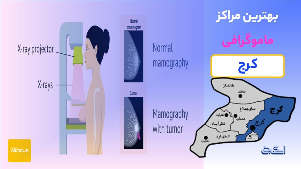 ماموگرافی در کرج