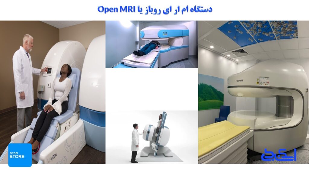 انواع ام ار ای روباز یا Open MRI